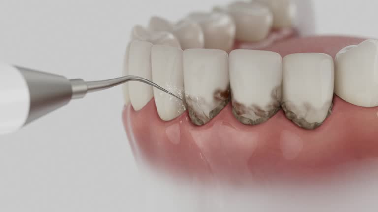 Reliable Dental contractor in Lewistown, MT by Dentist Open Now